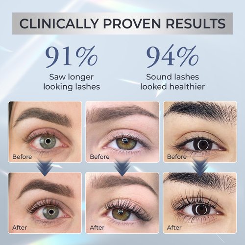 Abera Misan Eyelash Growth Serum – Natural Lash Booster with Red Ginseng, Biotin & Omega 3-6-9 – Fuller, Longer, Thicker Lashes – Safe for Sensitive Eyes (1 Box)
