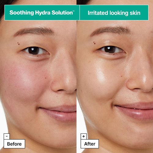 Dr.Jart+ Dermask Soothing Hydra Solution Korean Face Mask for Visibly Irritated Skin | Sheet Mask | Korean Skin Care, 5 Pack