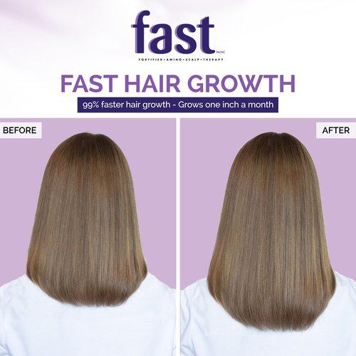 NISIM F.A.S.T Fortified Amino Scalp Therapy Shampoo & Conditioner- Promote Fast and Healthy Hair Growth (10 Ounce /300 Milliliter)