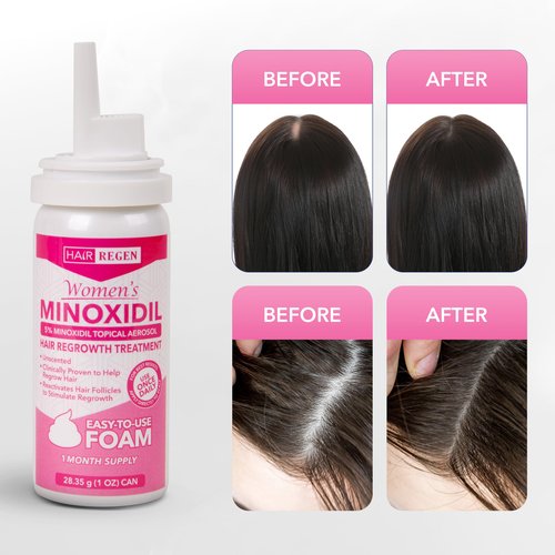 Hair Regen Minoxidil Foam for Women 5% Percent - Women's Hair Growth Treatment for Her - Topical Foaming Minoxidil for Women - Great for Hair Regrowth and Reduce Hair Loss - 6 Pack as 6 Month Supply