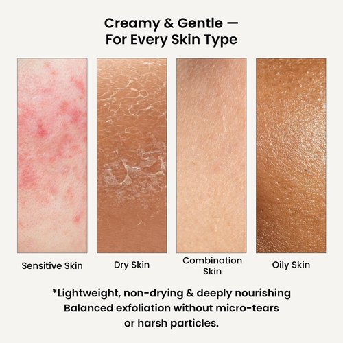 WildOak Korean Rice Scrub for Face & Body | Glass Skin | 4x Power of Shea Butter, Calendula, Ashwagandha & Licorice | Skin Tone & Removes Dead Skin Cells | Hydrating & Moisturizing Face Scrub | 3.52oz