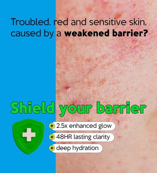 Troubless Clear Barrier Plus Booster Serum - Soothing & Hydrating Serum for Face w/Niacinamide & Tea Tree - Fast-Absorbing, Non-Greasy & Moisturizing (1.01 fl oz)