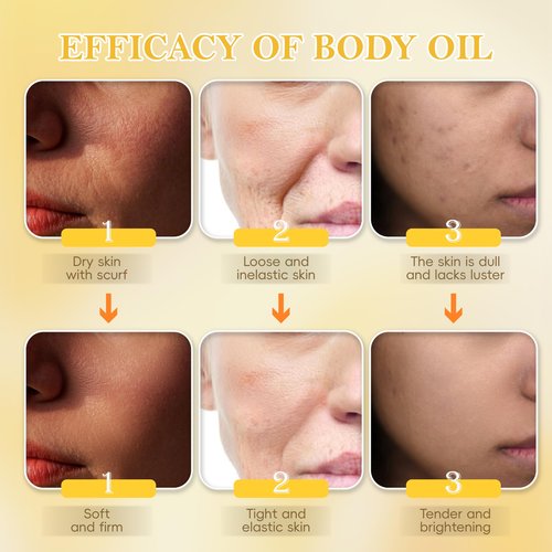 UPYOTTP Body Firming Oil, Luxury Body Oil for Skin Firm Tighten, Hydrating & Nourishing Dry Skin-With Jojoba,Vitamin E and Camellia Oil Natural Ingredent(4.06 FL OZ)