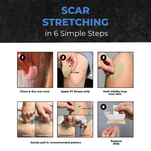 PT StrapZ Non-Elastic, Therapeutic Adhesive, Scar Tissue Mobilization, Scar Tissue Stretching, Therapeutic Tool to aid Recovery from Surgery or Trauma Health & Personal Care (20 strips)