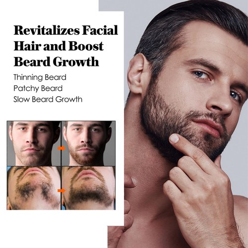 Minoxidil Beard Growth Oil: Minoxidil For Men Beard Infused With Biotin, Extra Strength Minoxidil 5% Beard Growth Serum to Grow Beard & Mustache Fast