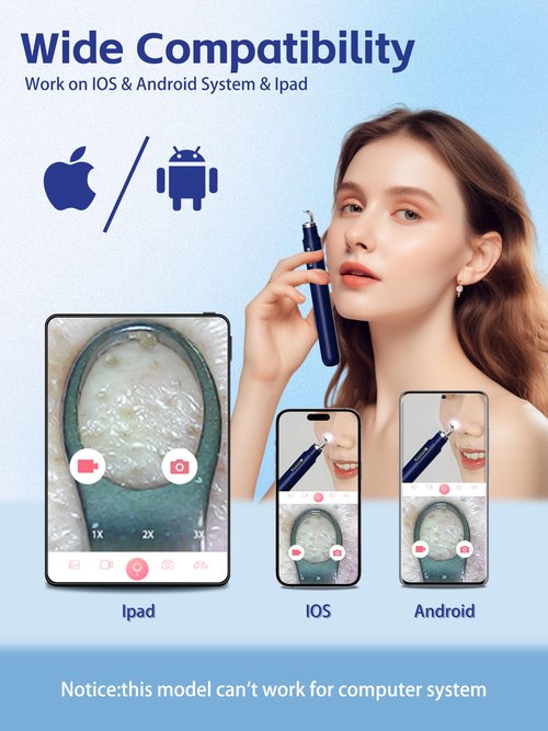 Visual Blackhead Remover Tools with Camera,Pimple Popper Extractor Tool Kit with Camera 20X 1080P Pore Cleaner Acne Comedone Whitehead Extractor Kit for iPhone/Android (Blue)