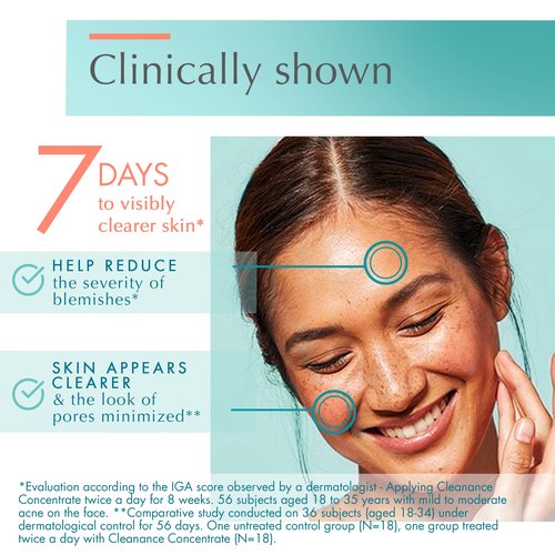 Avène Cleanance Concentrate Blemish Control Serum, clarifying water-gel, fragrance and silicone free, For acne-prone skin, airless pump, 1 fl. oz.