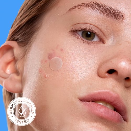 AVARELLE Pimple Patches Hydrocolloid Acne Patches, Acne Spot Treatment for Blemishes and Zit with Tea Tree Oil, Calendula Oil and Cica Oil for Face, Vegan, Cruelty F(8 XL + Variety + 80 CT)
