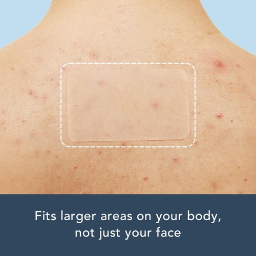 Rael Pimple Patches Large Spot Bundle - Korean Skin Care, Hydrocolloid, Zit Acne Patches for Face/Miracle Large Spot Control Cover (20 Count) & XL Spot Control Cover (6 Count)