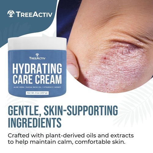 TreeActiv Psoriasis Cream, 8 oz, Soothing Moisturizing Cream with Hyaluronic Acid for Face, Scalp, and Body, Hydrates Scaly Dry Skin, 500+ Uses