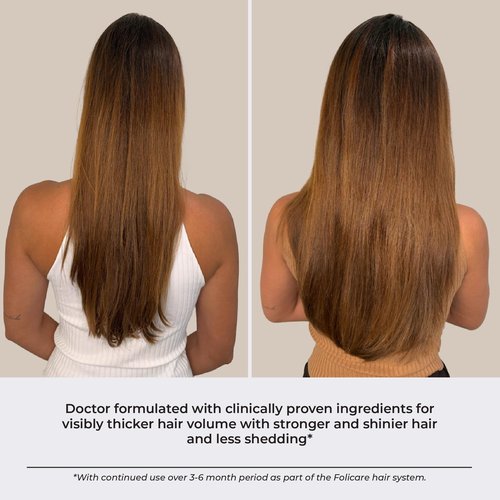 Hair Growth & Thickening Serum With Biotin & Rosemary (3-Pack) | Multi-Benefit for Thinning Hair, Breakage & Split Ends | Boosts Density, Repairs Damage, Hydrates Dry Scalp - For Men and Women