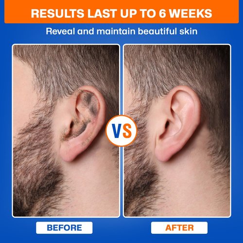 Wokaar 2-in-1 Ear & Nose Waxing Kit for Men & Women | 100g Hair Removal Wax + 99pc | 20 Applicators, 10 Nasal Sticks, 15 Wipes & 20 Earplugs | No Microwave Needed | Nose Wax Kit, Ear Hair Remover