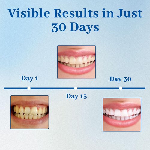 Nudenta Odontic Repair, Cavity Healing Tooth Armor Liquid, Nano Hydroxyapatite Remineralization Complex for Cavity Repair, Teeth Whitening with Remineralization Drops, Enamel Strengthening - 60ml