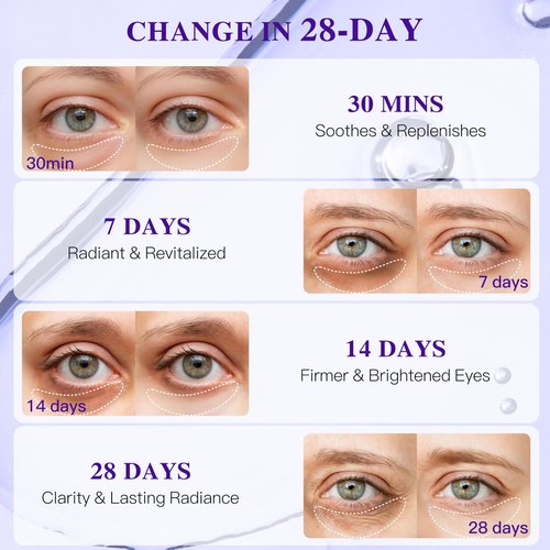 ICIKOL Collagen Under Eye Patches for Puffy Eyes and Dark Circles, Under Eye Mask for Radiance Boost with Blueberry, Hydrating Undereye Mask Patches for Treatment with Women Beauty (Purple, 24 Pairs)
