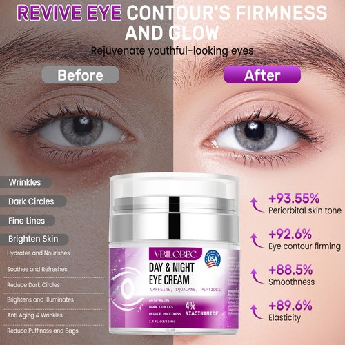 Vbilobec 2025 Latest Caffeine Eye Cream:[30+ SGS Certified] [Used by Over 1M Fans] Anti-aging Eye Cream to eliminate dark circles, puffiness, and fine lines.1.7 fl oz, for Women& Men,2PC