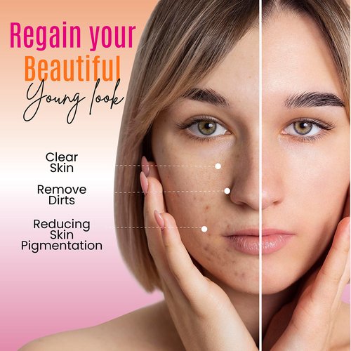 DERMAXGEN Organic Kojic acid & Vitamin C Soap Bar | Arbutin, Glutathione | Advanced Glowing formula, Replenish, & Radiant Skin | Pure Natural Pigmentation For Face & Body Cleanser - 5 OZ Each| (6)